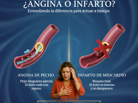 Dolor en el Pecho ¿Angina o Infarto?