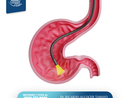 Endoscopia Alta Estómago Mérida Yucatán
