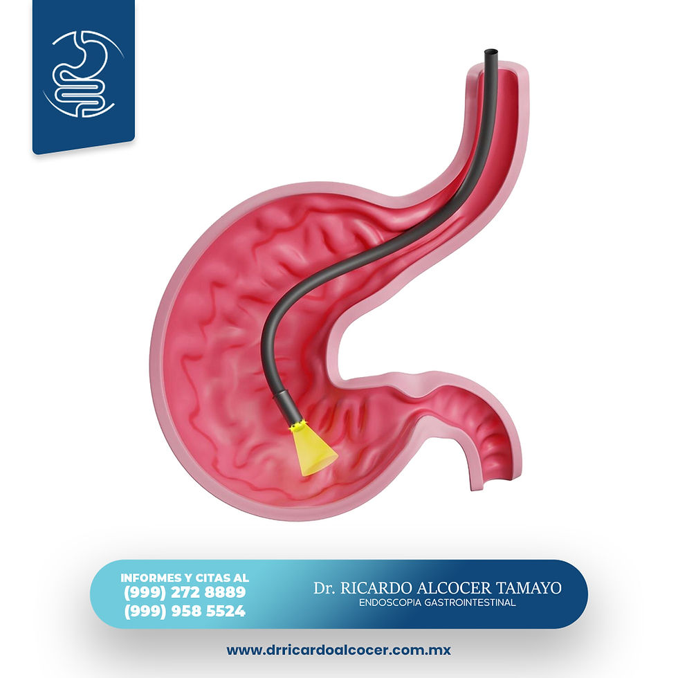 Endoscopia Alta Estómago Mérida Yucatán