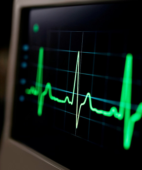 electrocardiograma-merida-yucatan-dr-alvaro-torre-cardiologo-clinico