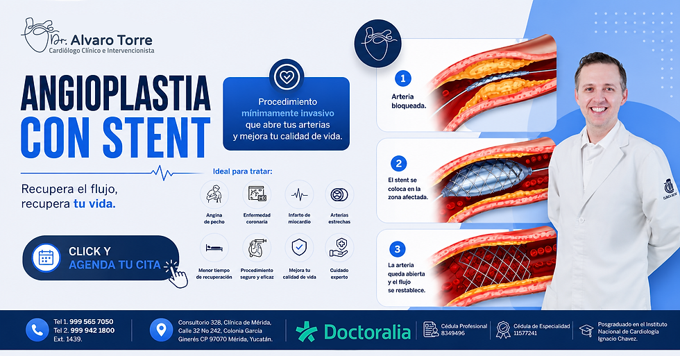 Angioplastia con Stent en Mérida Yucatán