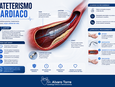 ¿Qué es un cateterismo cardíaco y para qué sirve? Guía completa para pacientes