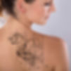 Tattoo-Removal-Square.jpg