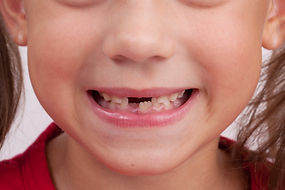 Baby's mouth with baby teeth dropped out