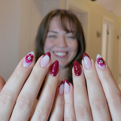 Ankara Çankaya yakını en iyi güzellik merkezi tırnak yeme tedavisi öncesi ve sonrası. Ankara tırnak yeme problemi çözümü yenmiş kısa tırnağa protez uygulaması.