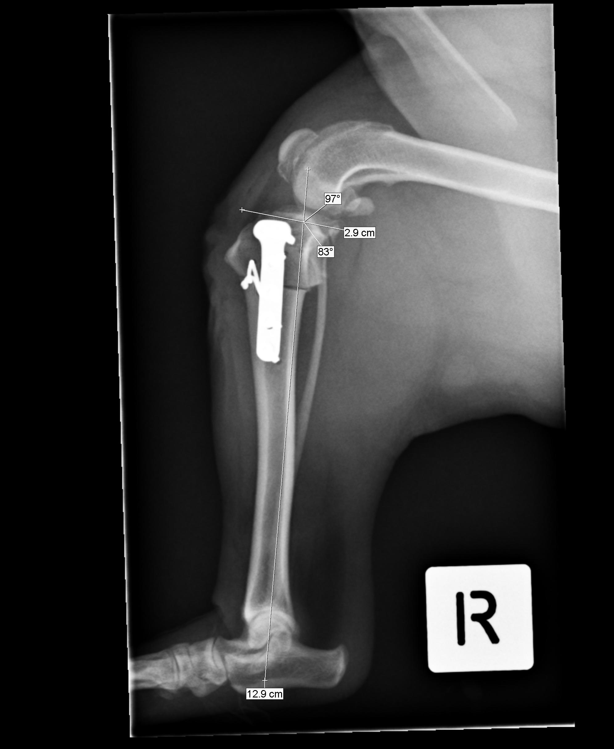 Late meniscal Injury Medial Meniscus Injury Dog Cruciate Surgery