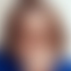 Lewis Capaldi - Forget Me