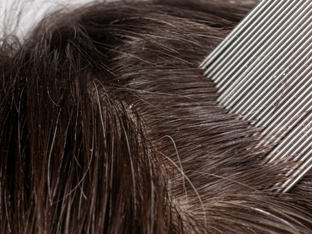 Head Lice: What You Need to Know