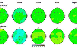 QEEG-well-regulated.jpg