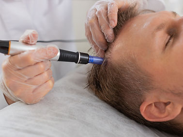 trichologist-doing-man-improve-hair-growth-procedure-dermapen-microneedling-vitamin-inject