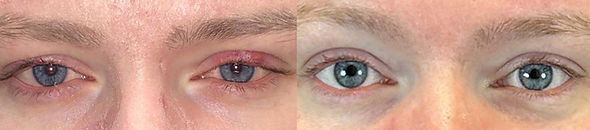 SP_Forma-I_Before&After_1_TM-Horizontal.jpg
