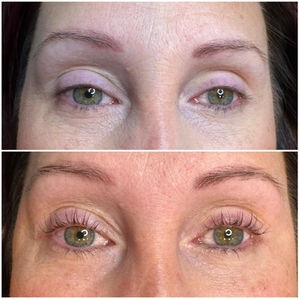 lash lift