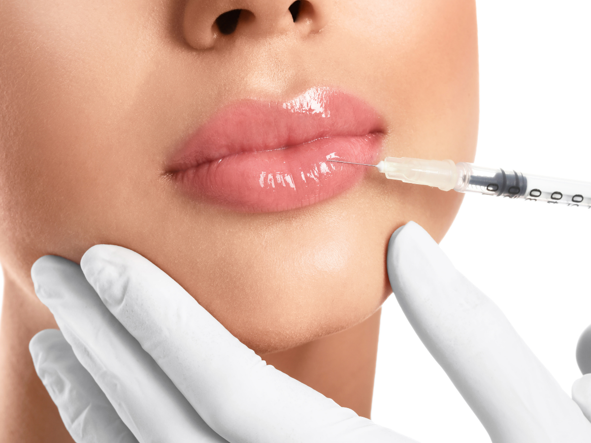 Lip Filler Euro Reflections Spa