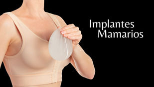 Implantes Mamarios: ¿Cómo elegir el ideal para ti según tu tipo de cuerpo?