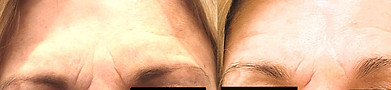 Before and After Kimberly Jan 7 26_edite