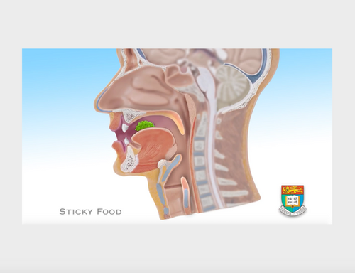 吞嚥困難 3 黏性食物 Sticky food | Care Food