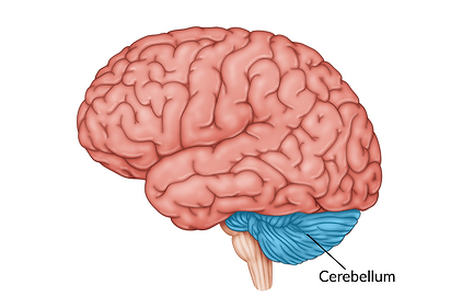 cerebellum-damage.png