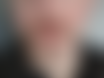 What Are the Latest Mustache Hair Transplant Trends?