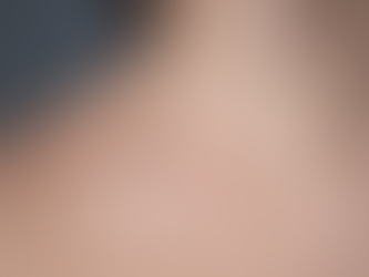 Does Scar Removal Improve Skin Texture?