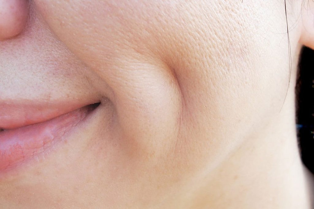 Dimples Man Made How Does Dimple Creation Surgery Affect Facial Aesthetics?