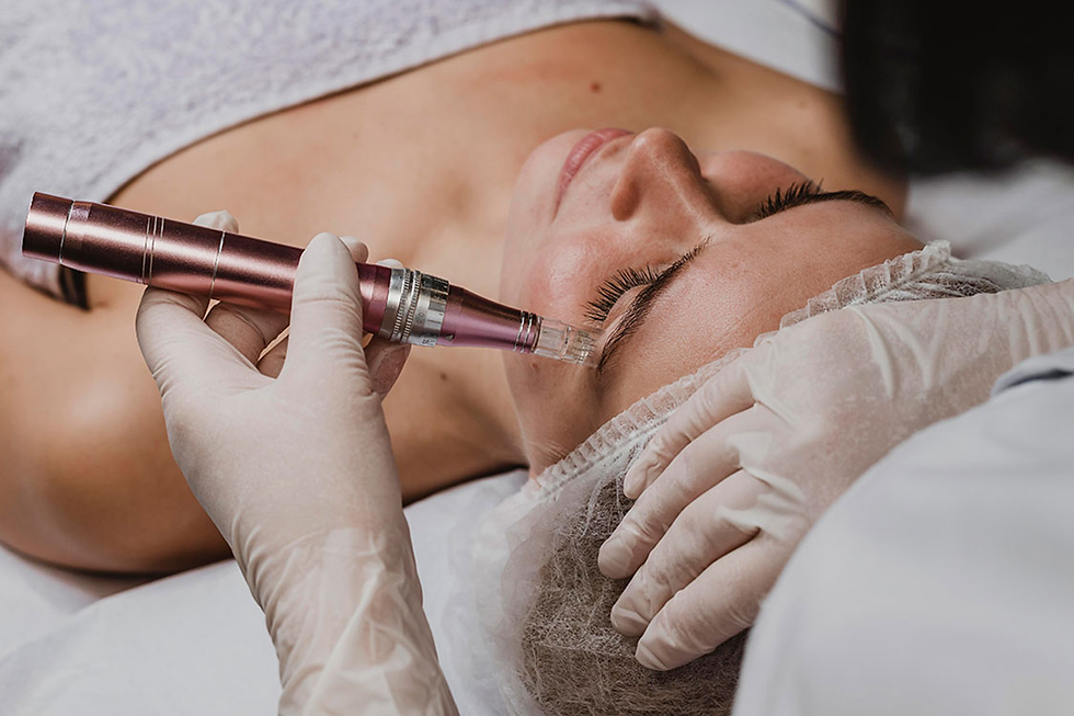 How Is Dermapen Treatment Performed?