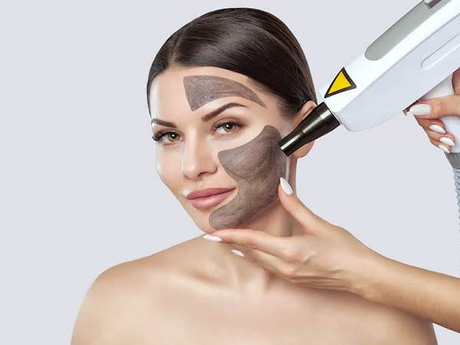 What Makes Laser Carbon Peel Different From Peels?
