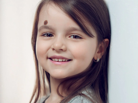 Does Birthmark Removal Leave Any Visible Marks Behind?