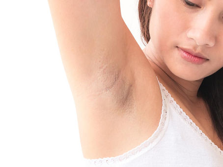 Why Should You Consider an Underarm Whitening Treatment in Dubai?