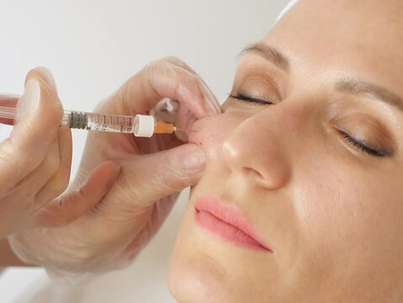 Does Your Face Need the Best Cheek Injections for Support?