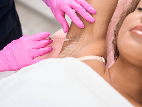 What Areas Beyond Under Arms Can Botox Treat for Sweat?