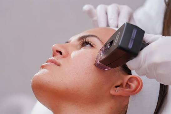 How Can Morpheus8 treatment Support Firmer Skin?