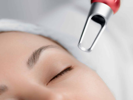 How to Prepare for Pico Laser Treatment in Dubai