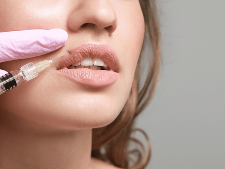 Does Russian Lip Filler Technique Lift Lips?