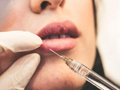 Does Lip Augmentation Support Facial Balance?