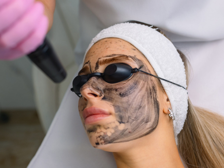 How Can Laser Carbon Peel Refine Skin Texture?