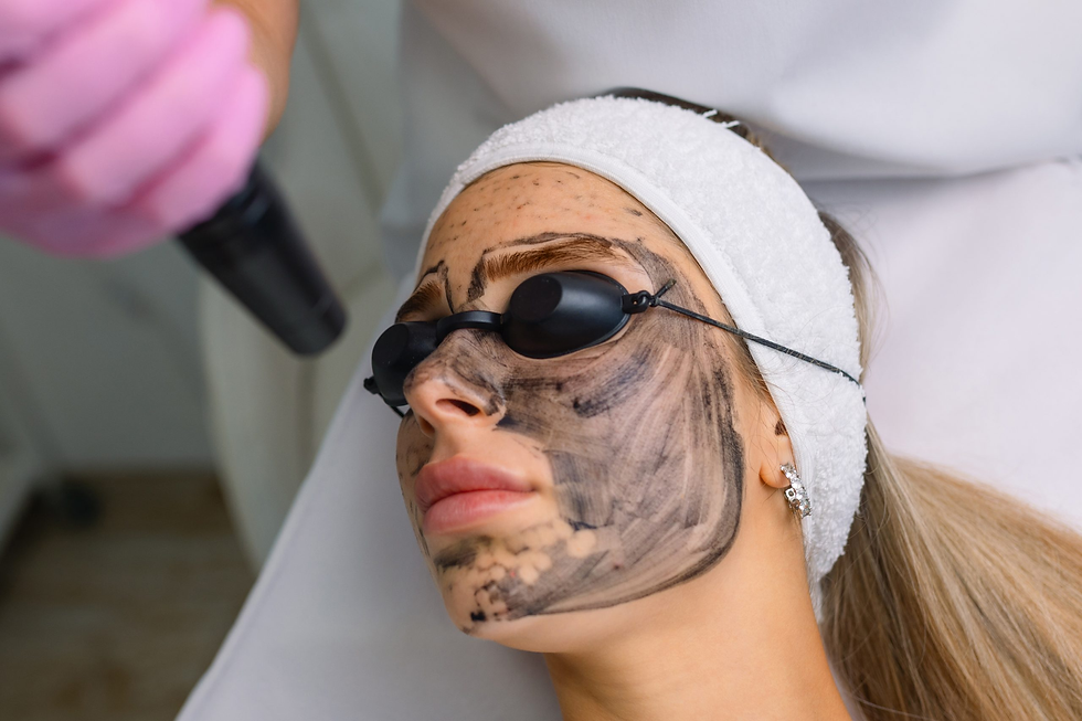 How Can Laser Carbon Peel Refine Skin Texture?