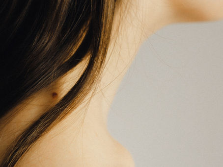 Understanding Skin Tags on the Inner Thighs