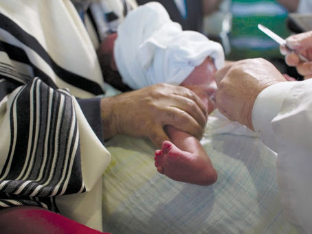 Health Benefits and Risks of Male Circumcision