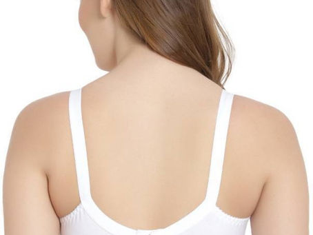 The Rise of Bra Line Lifts Most Popular Body Contour Procedure