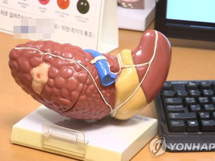 "'간헐적 절식'이 매일 적게 먹는 것보다 지방간 감소 효과 커"