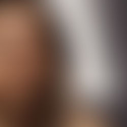 Nouvelle tendance; les EXOSOMES et l'ADN de saumon !