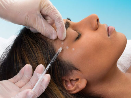 Non Surgical Support for Facial Palsy with Botox