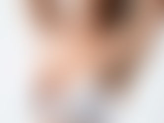 Natural Looking Breast Augmentation Result