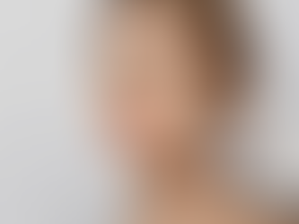 Exosome Therapy for Hair Growth and Skin Renewal