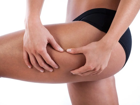 Advanced Thigh Lift Solutions