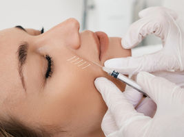 Juvederm Treatment for Smooth and Youthful Skin