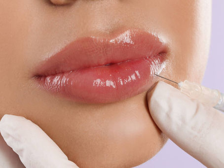 Discover the Art of Russian Lip Fillers