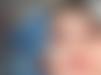 Restore Volume with Under Eye Fillers