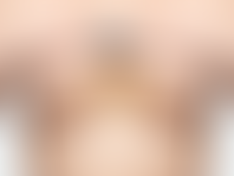 Transform Your Silhouette with Breast Enlargement Injections