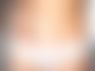 Discover the Benefits of Surgical Scar Revision